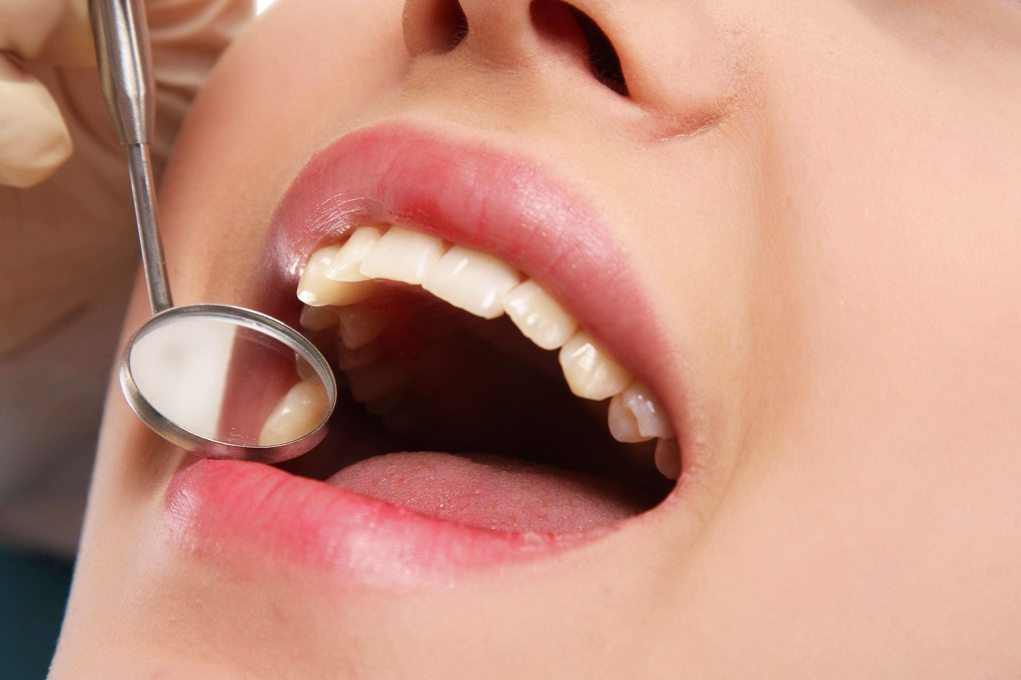 Dental exam