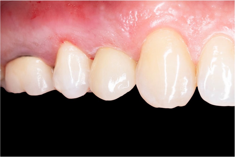 crown-bna_1 crown-bna_1